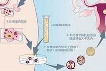 太仓市生孩子做染色体检查有必要吗，筛查一次大概需要多少钱？