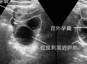鹤岗市生孩子做染色体检查有必要吗，筛查一次大概需要多少钱？